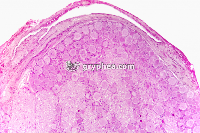 Ganglion rachidien x25 - gryphea.com